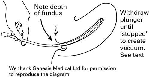 ENDOMETRIALE ENTNAHME