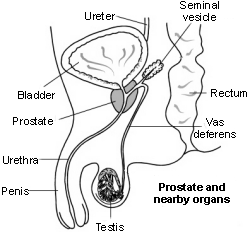 Querschnittsdarstellung der Prostata und der umliegenden Organe