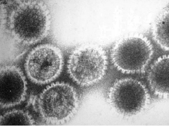 Humanes Herpesvirus