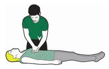 CPR Erwachsene