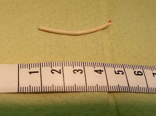 empfängnisverhütendes Implantat Implanon