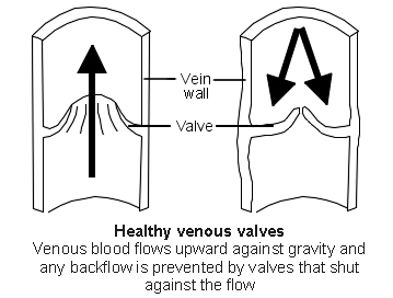 Normale Ventile