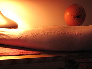 Dermatographische Urtikaria