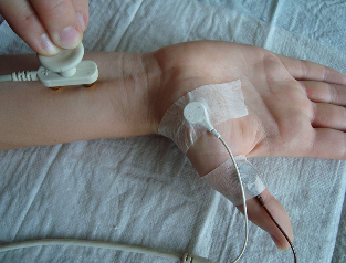 Geschwindigkeit der Nervenleitung