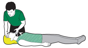 Öffnen Sie die Atemwege Erwachsener