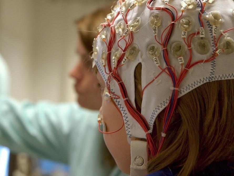 Arten von Krampfanfällen