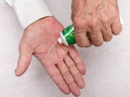 Virusbedingte Hautausschläge