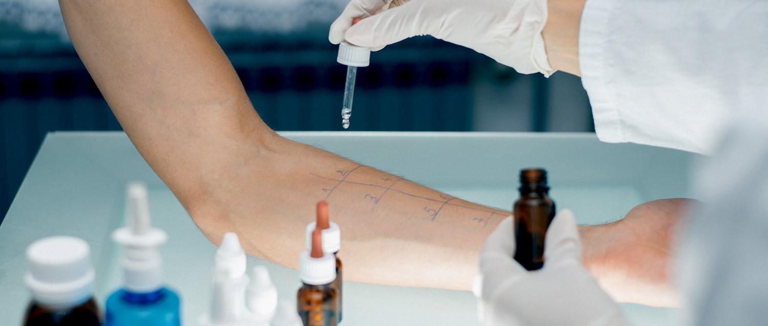 Privater Allergietest
