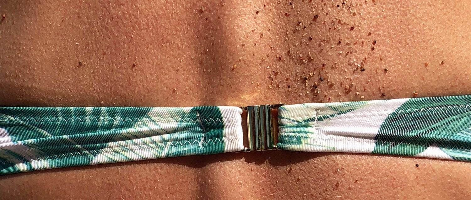 Sonne und Sonnenbrand