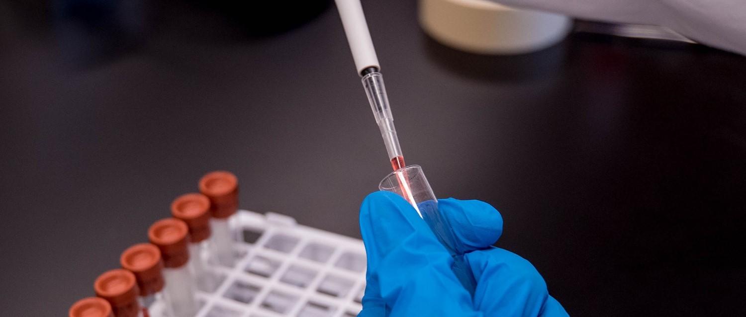 Streptokokken A Neuer Stamm