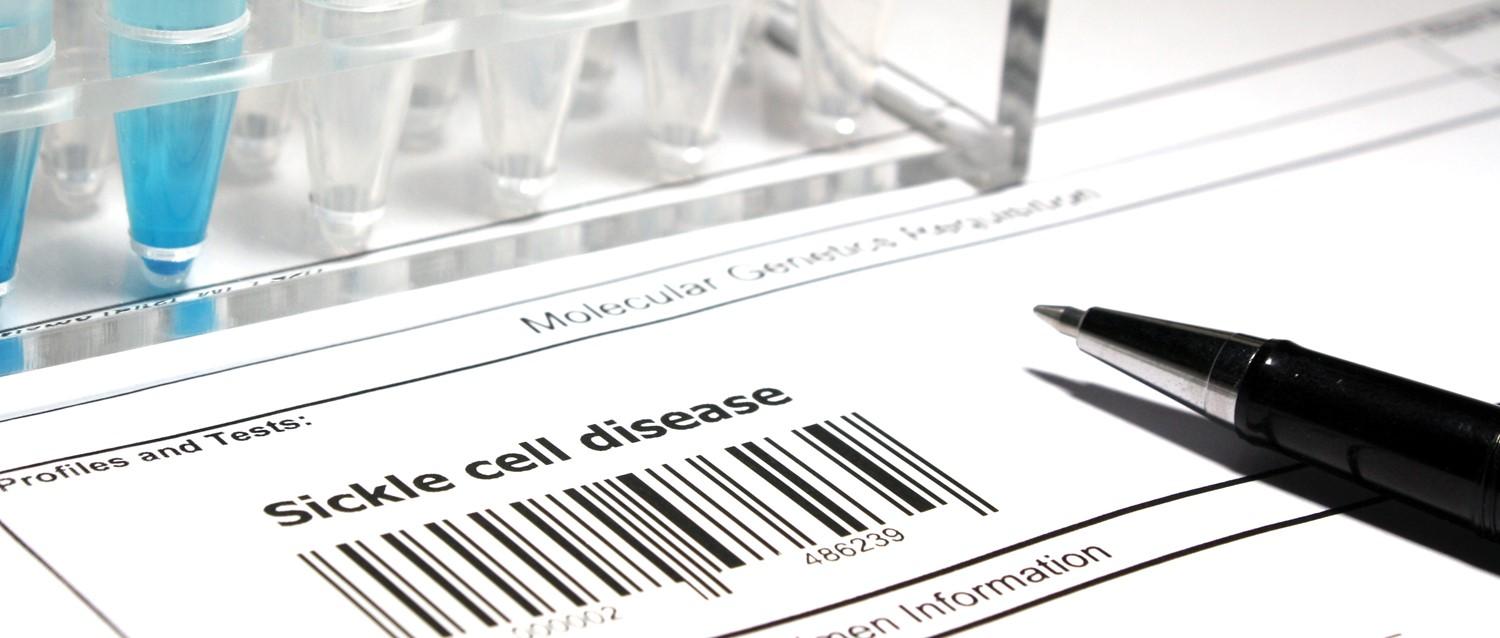 Was bedeutet die neue Behandlung der Sichelzellkrankheit für Sichelzellpatienten?
